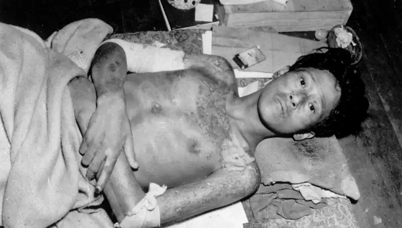 80 Yıl Sonra Nagasaki’den Gelen Uyarı: Nükleer Felaket Tehdidi Artıyor