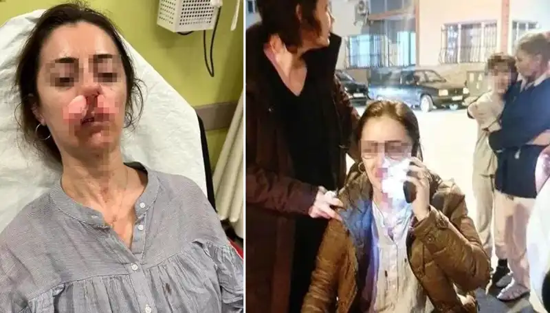 Otomobil Kapısı Silah Sayıldı: Eşinin Sevgilisi Sandığına Saldırdı!