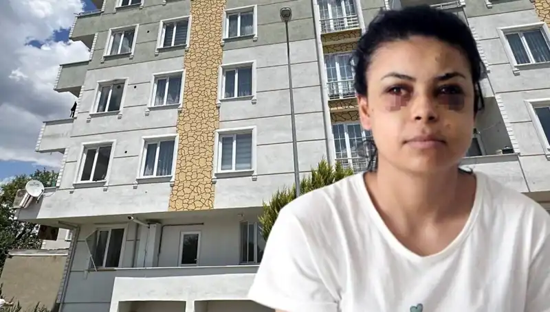 Düğün Kutlamasında Maganda Dehşeti: Saçmalar Kurbanın Gözüne Isabet Etti